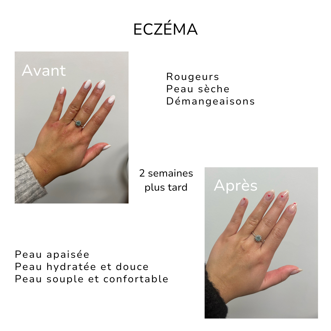 Bienfaits de la crème pour les mains ÖL cosmétiques pour soulager l&