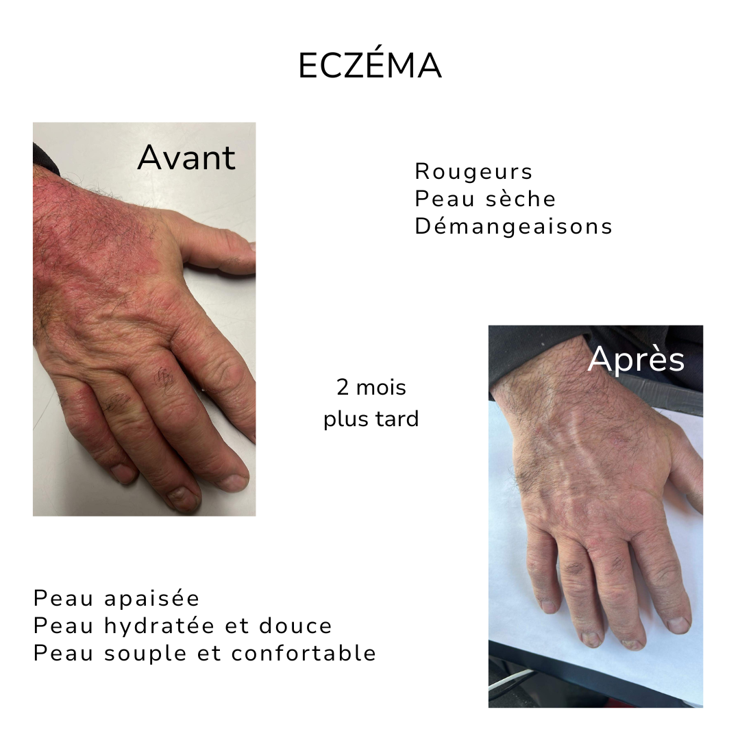 Bienfaits de la crème pour les mains ÖL cosmétiques pour soulager l&