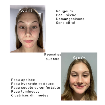 ROUTINE PEAU SENSIBLE